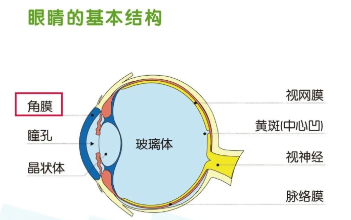 名医推荐  为什么近视手术前要停戴隐形眼镜(图3)